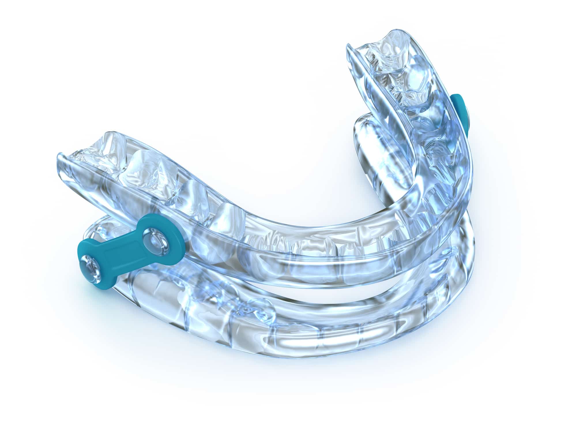 Clear dental oral appliance used to help manage sleep apnea in Pittsburgh, PA Metro Area